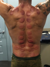 Load image into Gallery viewer, CUPPING WORx™ Kit