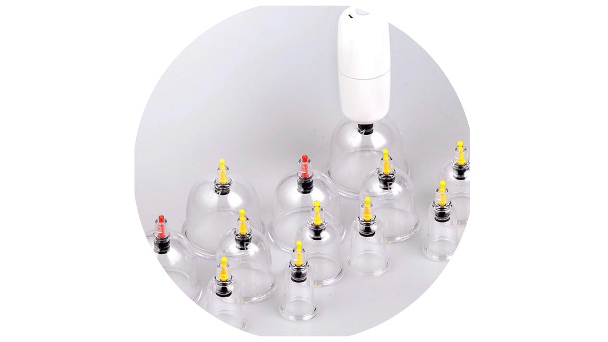 CUPPING WORx electric cupping set.